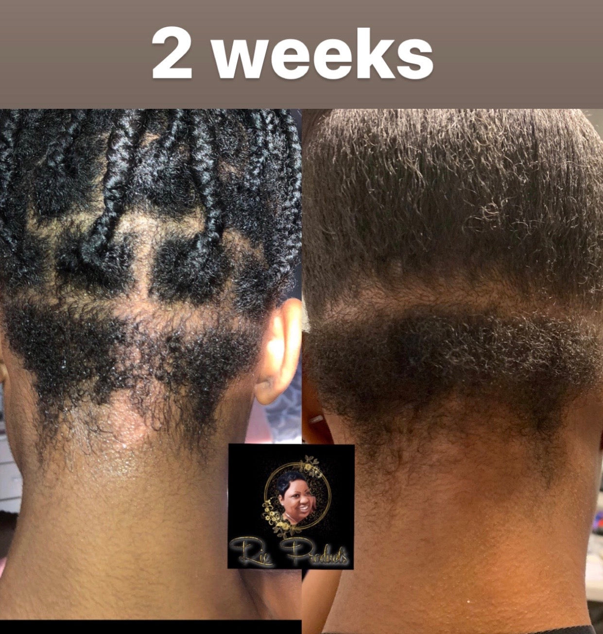You Grow Girl Hair Growth Oil