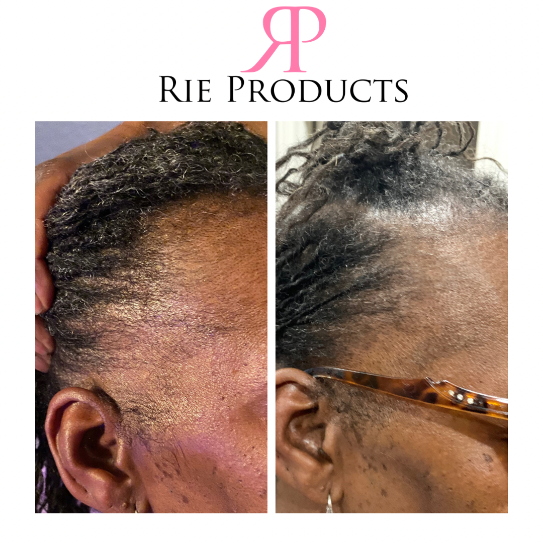 You Grow Girl Hair Growth Oil