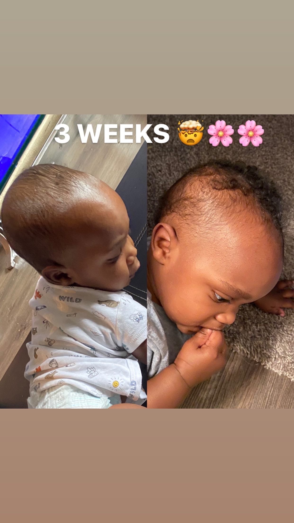 You Grow Girl Hair Growth Oil