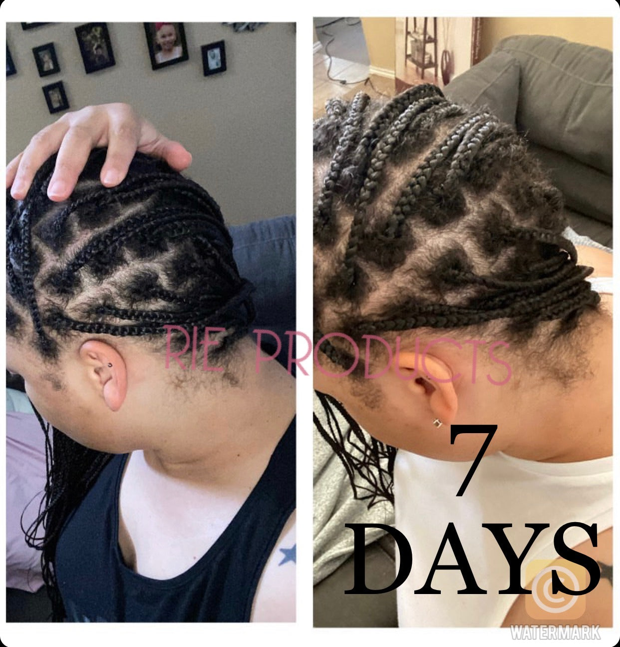 You Grow Girl Hair Growth Oil