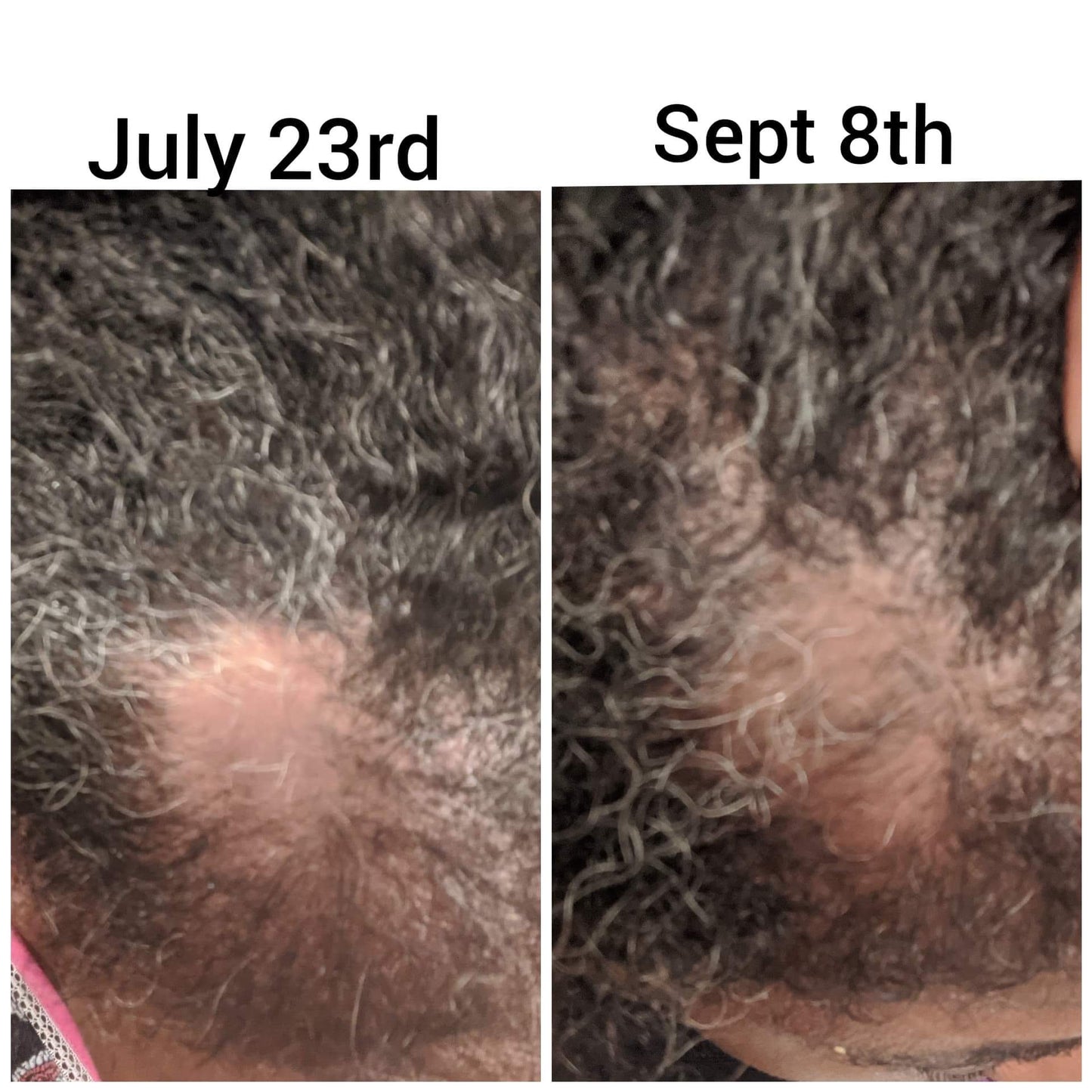 You Grow Girl Hair Growth Oil