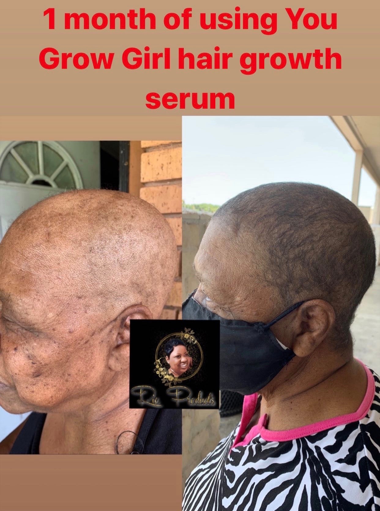 You Grow Girl Hair Growth Oil