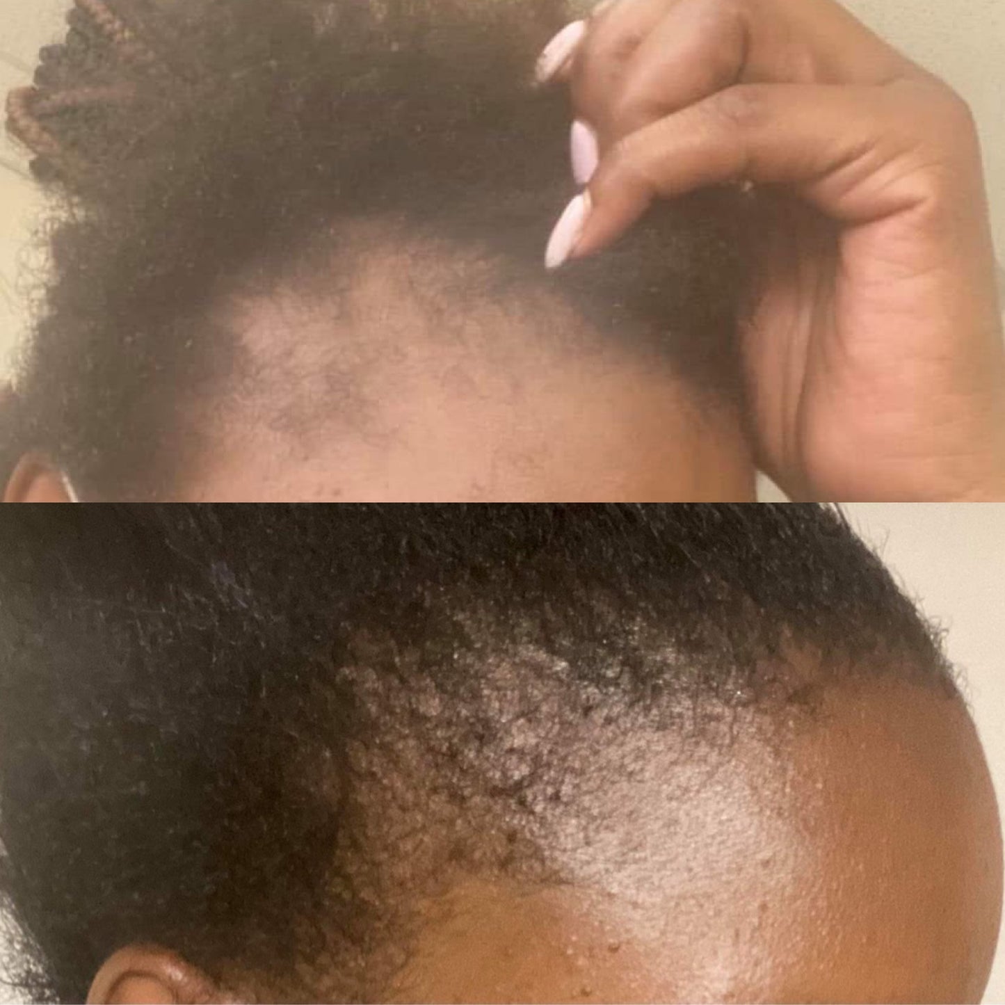You Grow Girl Hair Growth Oil