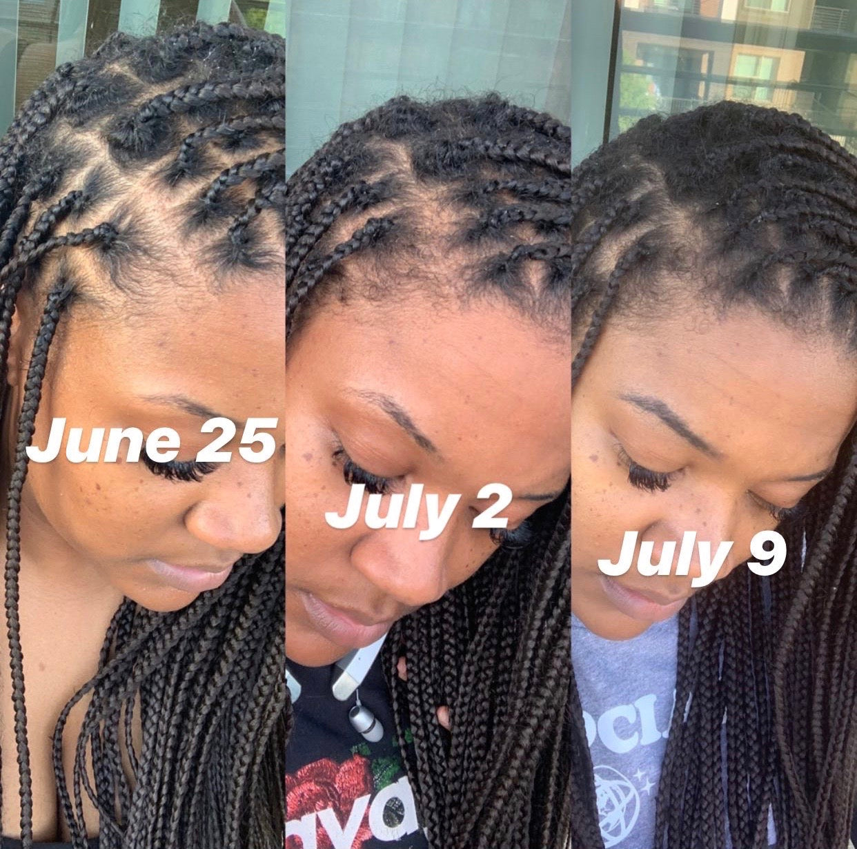 You Grow Girl Hair Growth Oil